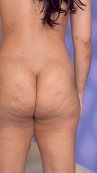Clench Buttocks