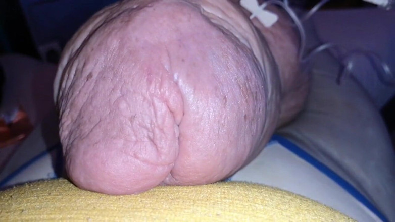 Monster_Meat_: Cockzilla s regresa después de agregar glucosa de 2liters