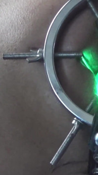 Backdoor Lightshow