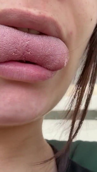 Sneezing From Flowers but Loving It Allergy Turns Sensual