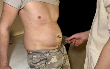 Navel fans