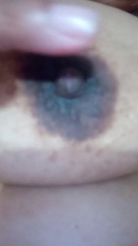 Nipples