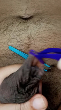 Melancap Peranan Berpangkat Foreskin Terbaik