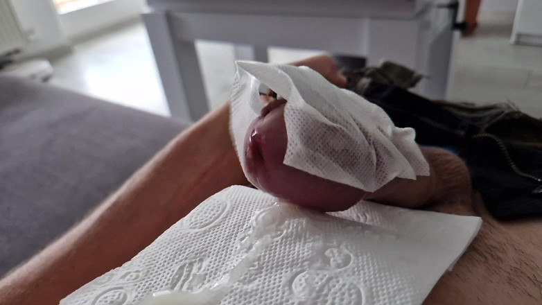 Lysyosiem: Dengan mainan