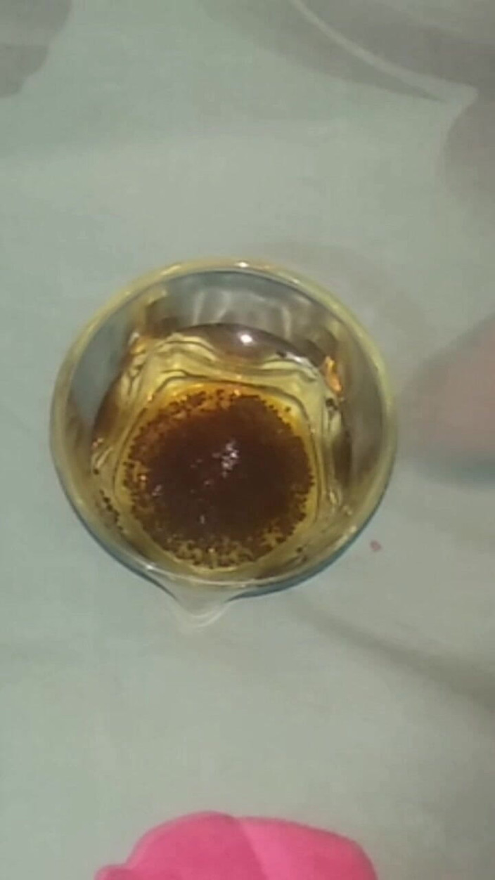 Aeddy: Sperma/spermaku Pakai Kopi Hitam.