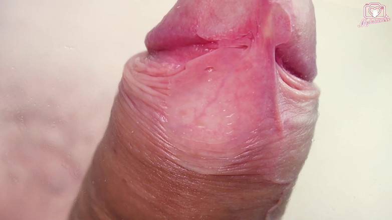 Medi Voi: Триггер Камеры С Точки Зрения Лица