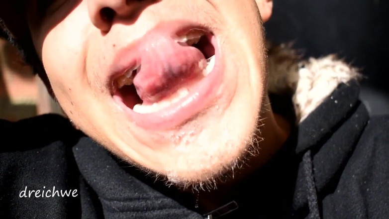 Dreichwe: Tongue game