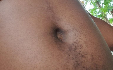 BMCs: Oh noktaya sikiş