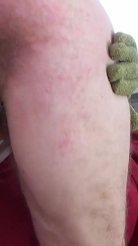 Nettles Work a Submissive Cunt in and Out