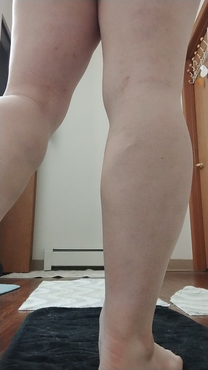 JG Risk: 11-9-2025 Vitelli, Vitelli ed altri vitelli