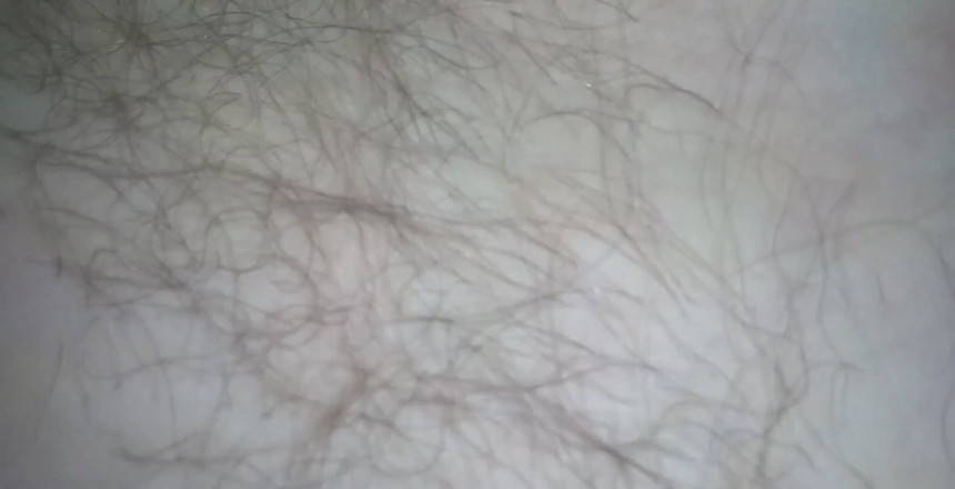 Kitty Delgato: Hairy pits close up