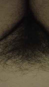 Pepek berbulu dan Bellybutton
