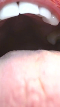 Inside My Big Mouth Tongue Teeth Uvula
