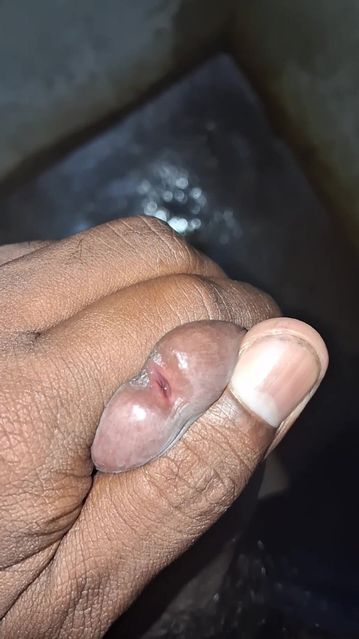 Priya X: Masturbation is the self-stimulation of genitals for sexual pleasure, often...