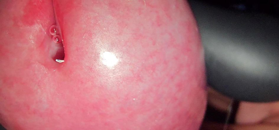 ScorpionSaver: Mikroskopis close up di penisku