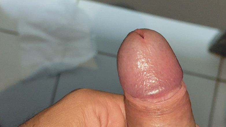 Straight Daddy Club: Velké deformované péro s Hrudkovitým žaludem.