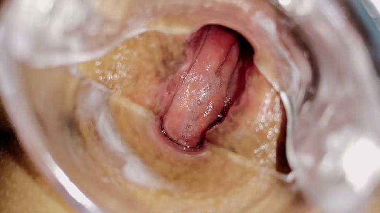 Helena Moeller: Stort brunt rövhål öppnade närbild till kameran