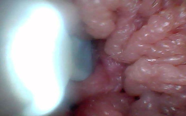 Twittiy: La cámara de endoscopio muestra las partes más sensibles del...