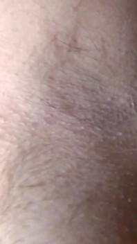Closeup Fresh Growth Hairy Armpits