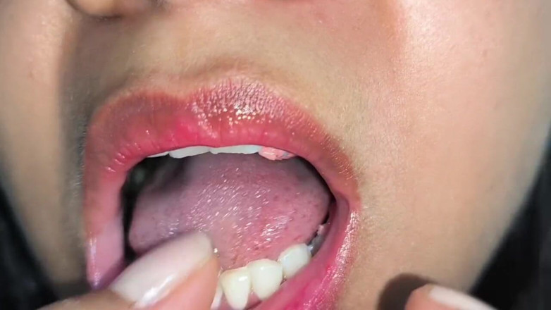 Isabel: Snake Gum