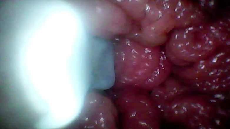 Ladybottox: Endoscope Camera Records My Wife's G Spot. Educational Video Close...