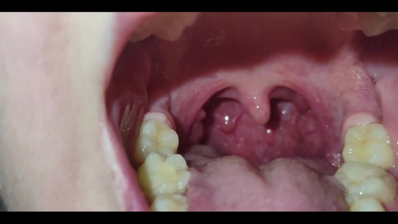 RavenHearth666VIP: A Close-up of My Throat