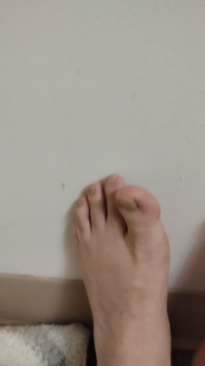 JG Risk: 11-26-2025 Roztomilé malé prsty