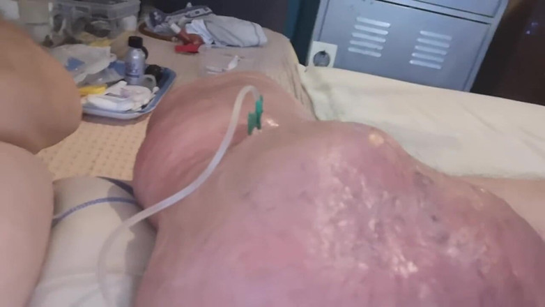 Monster_Meat_: 2litóris de glicose dentro da minha carne de silicone