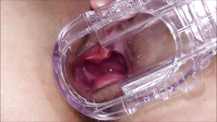 Helena Moeller: Оглядова дзеркала шийки матки в отворі пизди крупним планом