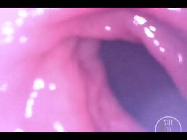 Lina Free: POV 익스트림 딥 애널 검사!