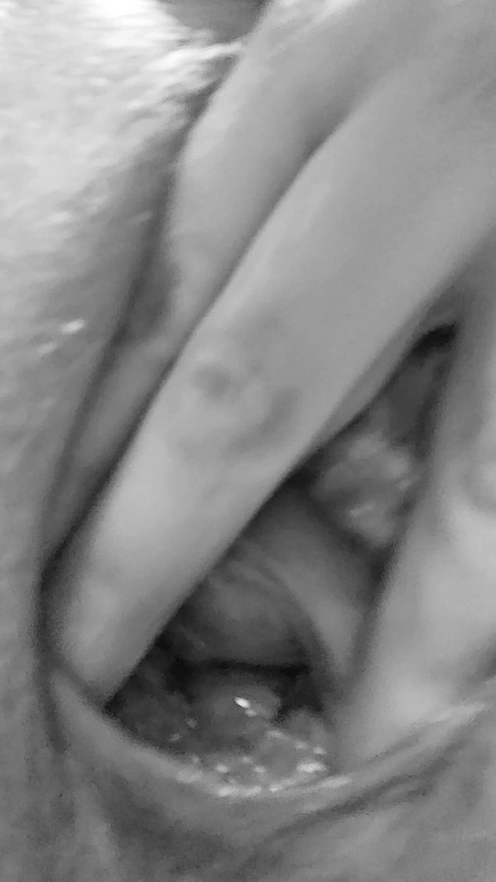 Misses Dickinson and Roughael: Pepek berminyak melancap