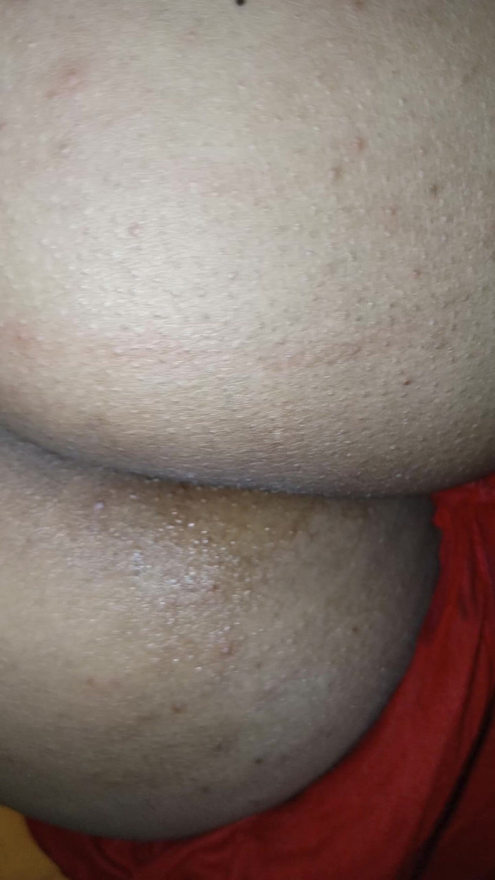 Nadiyabd: Bangla Big Ass Fucked with Oil in Pussy Hole