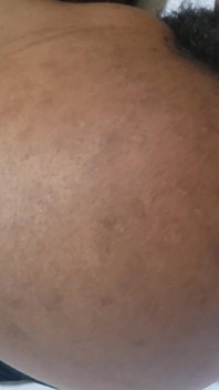 Big Ass Nogi MILF Porno British & Naked Hairy Pussy