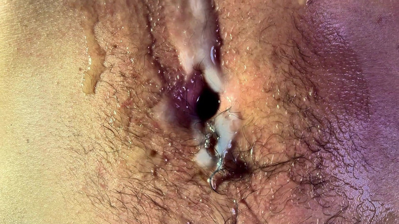 Navel fans: 발기 및 얼음 - 열, 추위 및 완전한 제어