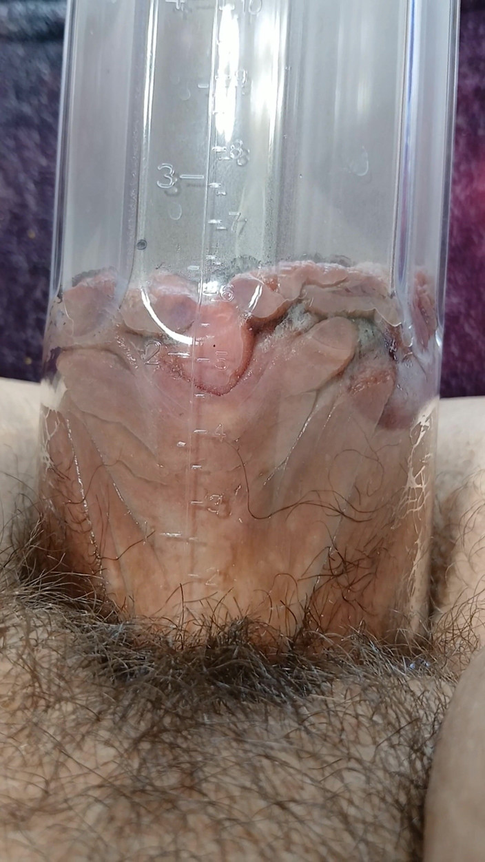 LunaXscorpia: Lunaxscorpia âm hộ được bơm lên