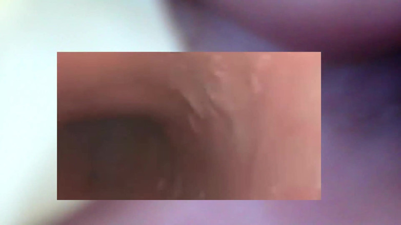 Nicoletta Embassi: Devour Teeth Fetish