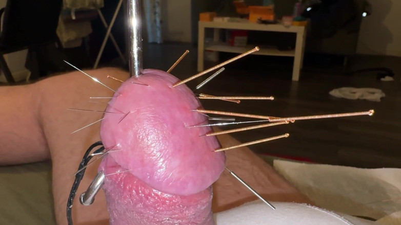 Qualzucht: Acupuncture - Orgasm!