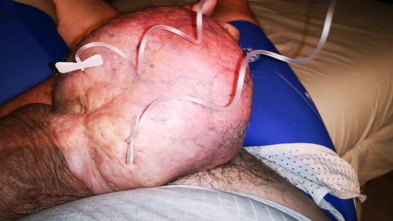 Monster_Meat_: Заполнение 2-х литров одновременно