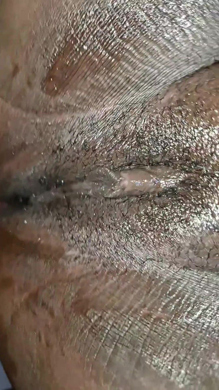 BMCs: Kont succesvol ontmaagd, ze schreeuwde zo hard, ze hield ervan