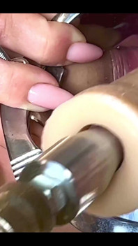 Editing New Cervix Penetration Video