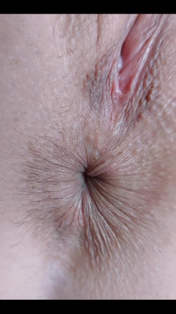 My Little Eye Is Winking at You! Would You Like to Lick It?
