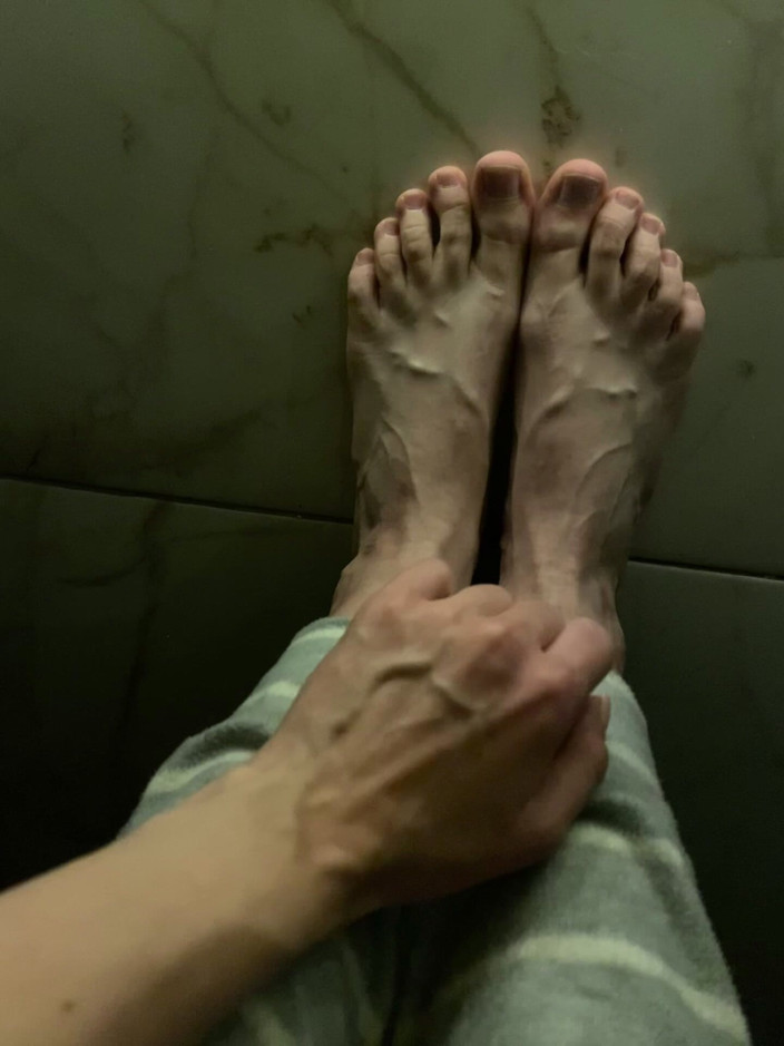 Princess Aisha: So Swollen Veins on the Feet