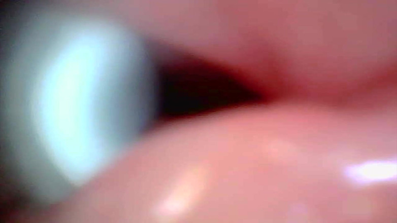 Ladybottox: Endoscope Camera Captures Moment of Male Ejaculation 4K