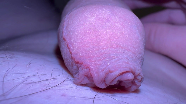 Nalekhome: Macro skin sul mio cazzo