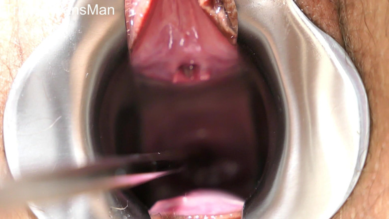 TripleXTransMan: 내 자궁 경부를 관통!