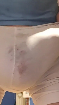 Vulging Show After Pumping up