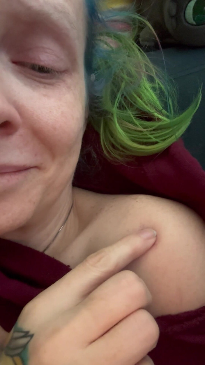 Hot potato girl: Drücken auf meine blauen flecken cuz, er würde es mögen