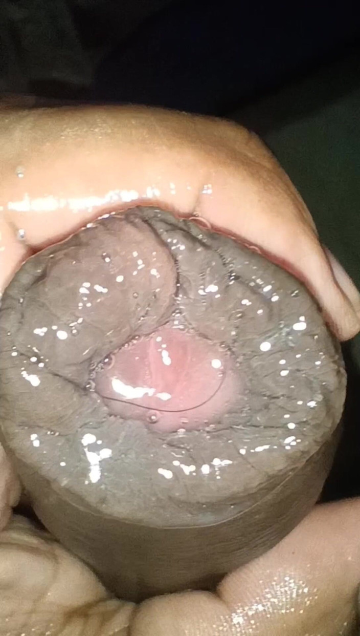 Tommhot: Close-up of Foreskin and Ejaculation in My Pants