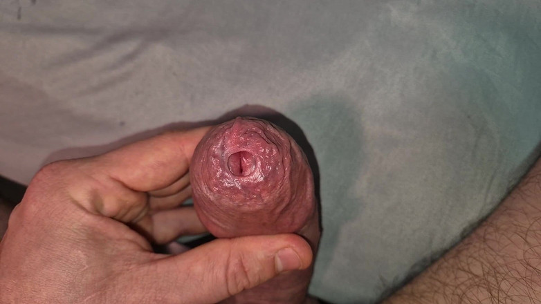 GloomyChase977: Phimosis büyük yarak yakın çekim, çok ateşli!