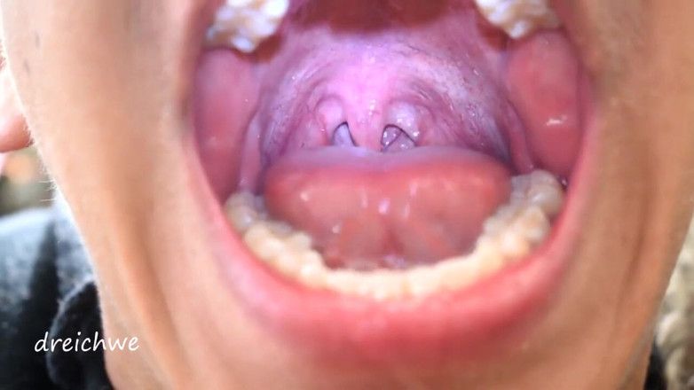 Dreichwe: Uvula fetish mouth